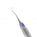 Скейлер Nevi Anterior (SCNEVI1XE2) двусторонний